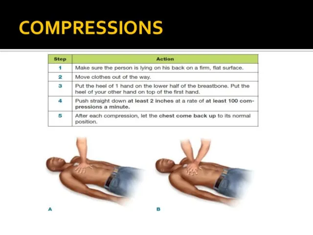 COMPRESSIONS