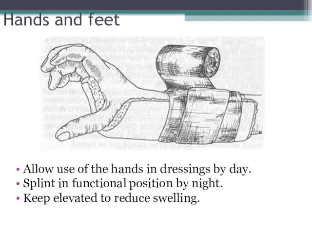 Hands and feet Allow use of the hands in dressings