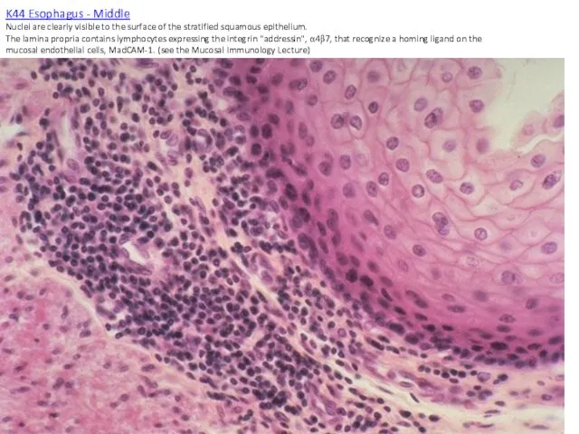 K44 Esophagus - Middle Nuclei are clearly visible to the