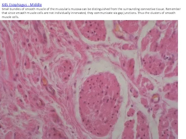 K45 Esophagus - Middle Small bundles of smooth muscle of