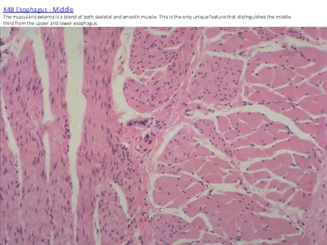 K48 Esophagus - Middle The muscularis externa is a blend