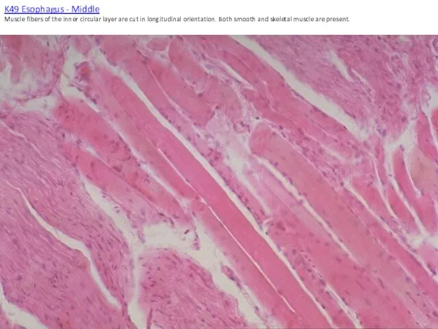 K49 Esophagus - Middle Muscle fibers of the inner circular