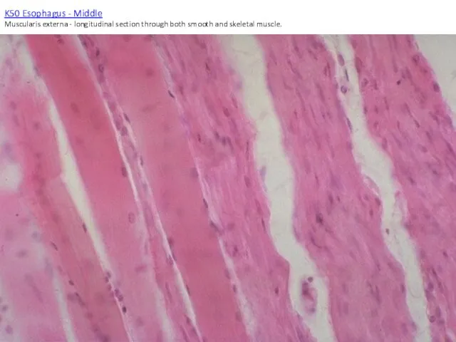 K50 Esophagus - Middle Muscularis externa - longitudinal section through both smooth and skeletal muscle.