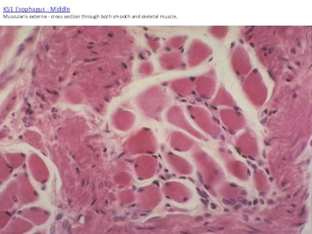K51 Esophagus - Middle Muscularis externa - cross section through both smooth and skeletal muscle.