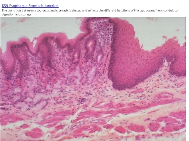 K59 Esophagus-Stomach Junction The transition between esophagus and stomach is