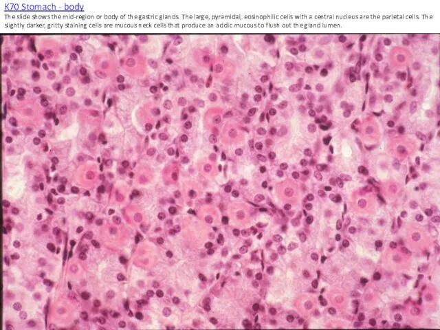 K70 Stomach - body The slide shows the mid-region or