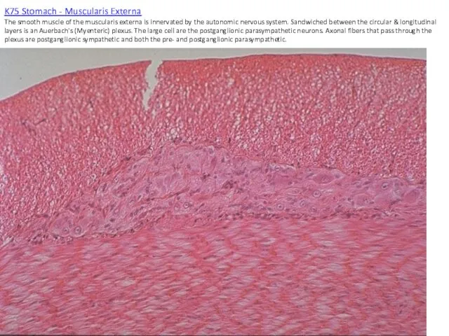 K75 Stomach - Muscularis Externa The smooth muscle of the