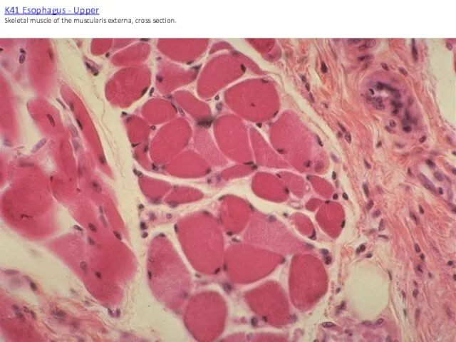 K41 Esophagus - Upper Skeletal muscle of the muscularis externa, cross section.