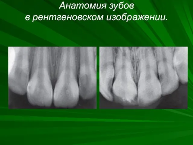 Анатомия зубов в рентгеновском изображении.