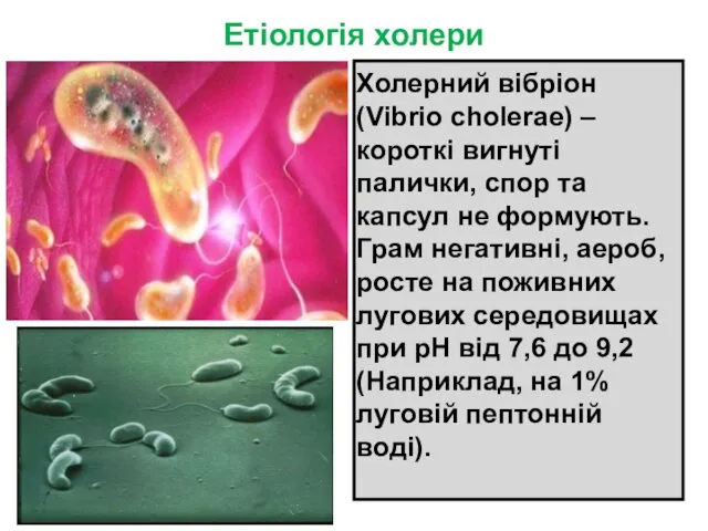 Етіологія холери Холерний вібріон (Vibrio choleraе) –короткі вигнуті палички, спор