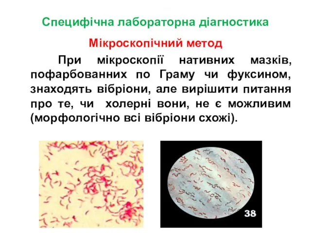 Специфічна лабораторна діагностика Мікроскопічний метод При мікроскопії нативних мазків, пофарбованних