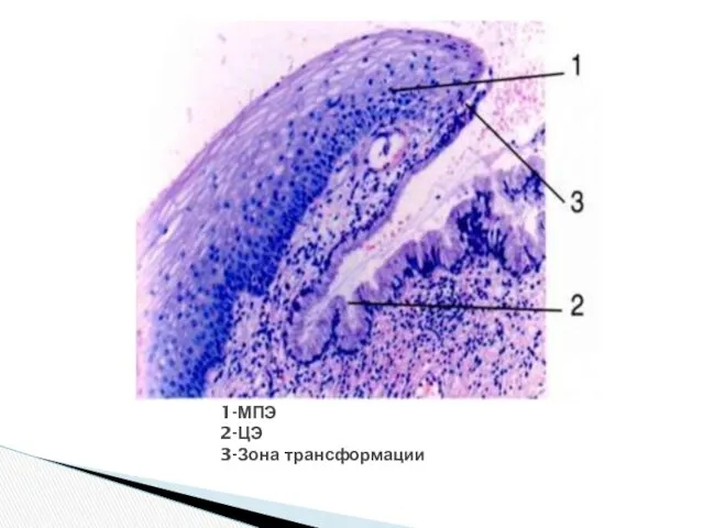 1-МПЭ 2-ЦЭ 3-Зона трансформации