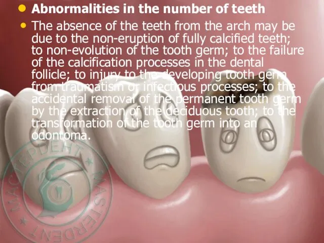 Abnormalities in the number of teeth The absence of the