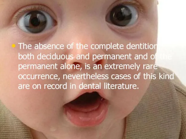 The absence of the complete dentition, both deciduous and permanent