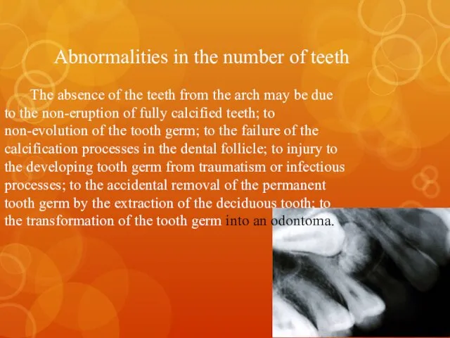 Abnormalities in the number of teeth The absence of the