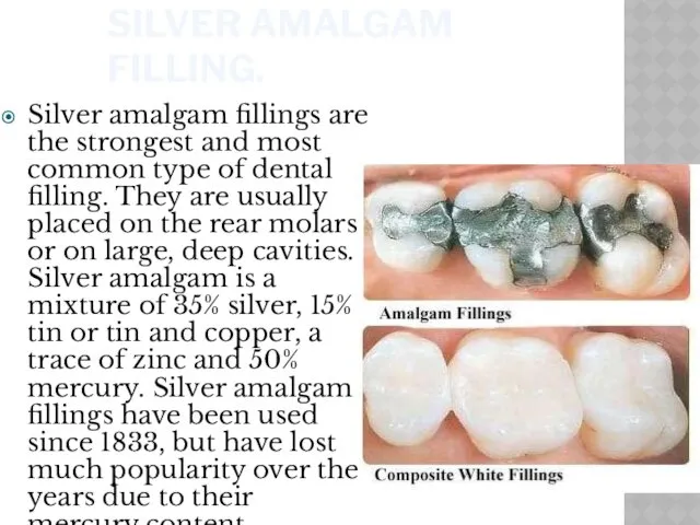 SILVER AMALGAM FILLING. Silver amalgam fillings are the strongest and