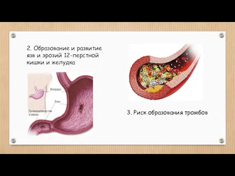 2. Образование и развитие язв и эрозий 12-перстной кишки и желудка 3. Риск образования тромбов