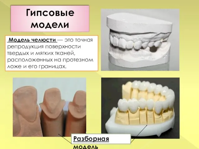 Гипсовые модели Модель челюсти — это точная репродукция поверхности твердых