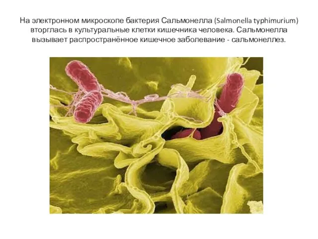 На электронном микроскопе бактерия Сальмонелла (Salmonella typhimurium) вторглась в культуральные