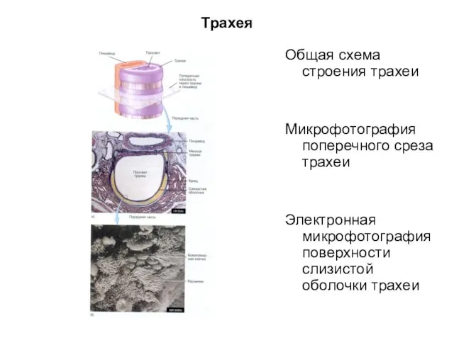 Трахея Общая схема строения трахеи Микрофотография поперечного среза трахеи Электронная микрофотография поверхности слизистой оболочки трахеи