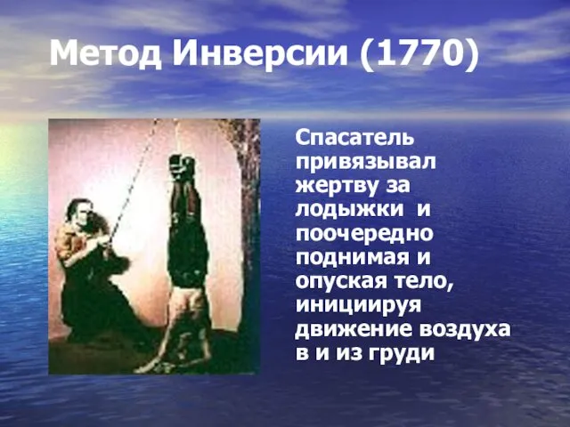 Метод Инверсии (1770) Спасатель привязывал жертву за лодыжки и поочередно поднимая и опуская