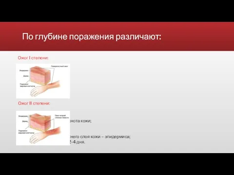 По глубине поражения различают: Ожог II степени: глубокое поражение верхнего