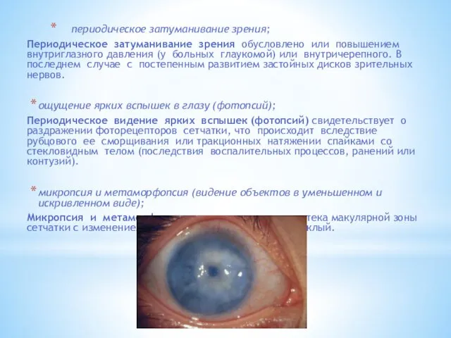 периодическое затуманивание зрения; Периодическое затуманивание зрения обусловлено или повышением внутриглазного