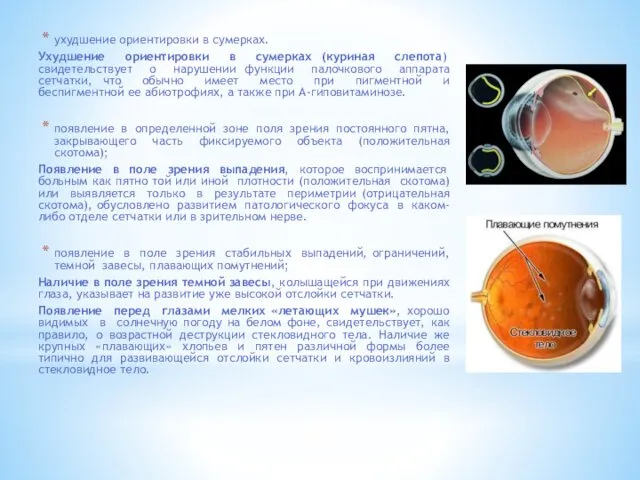 ухудшение ориентировки в сумерках. Ухудшение ориентировки в сумерках (куриная слепота)