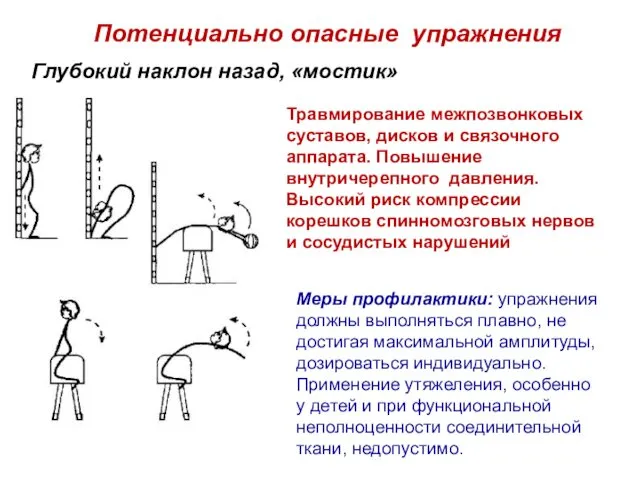 Глубокий наклон назад, «мостик» Потенциально опасные упражнения Травмирование межпозвонковых суставов,