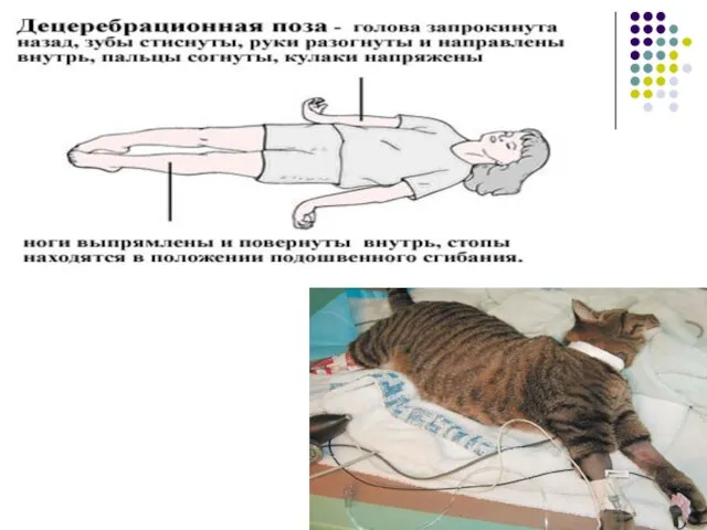 Функции Среднего мозга