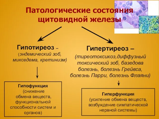 Патологические состояния щитовидной железы Гипотиреоз – (эндемический зоб, микседема, кретинизм)