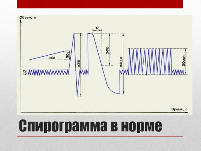 Спирограмма в норме