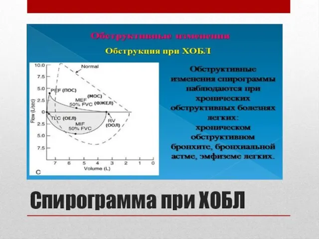 Спирограмма при ХОБЛ