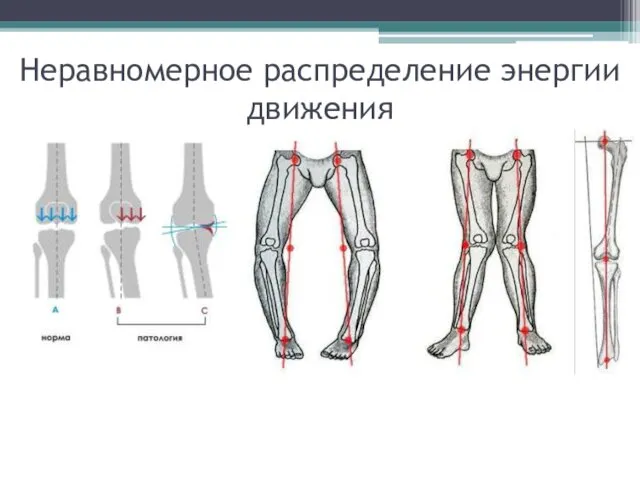 Неравномерное распределение энергии движения