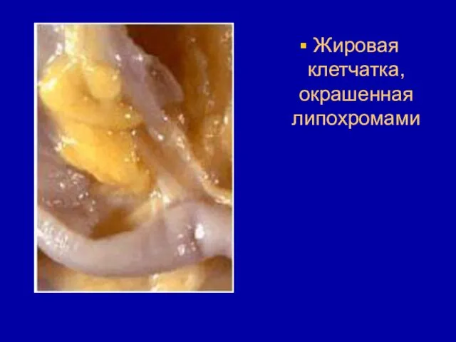 Жировая клетчатка, окрашенная липохромами