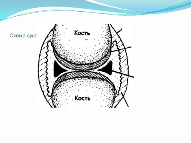 Схема сустава