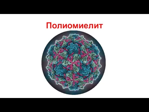 Полиомиелит