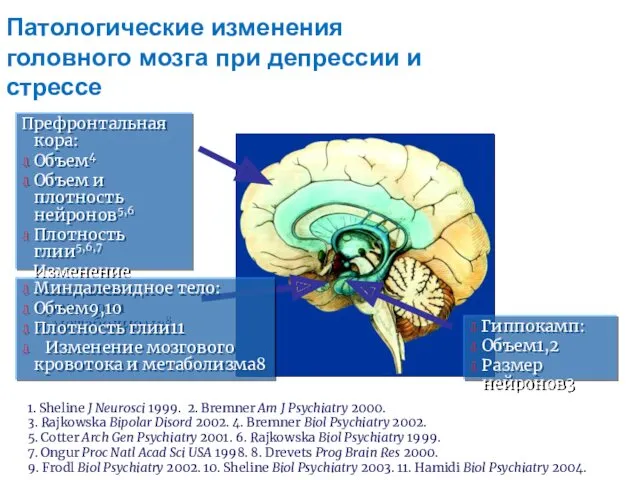 Патологические изменения головного мозга при депрессии и стрессе Префронтальная кора: