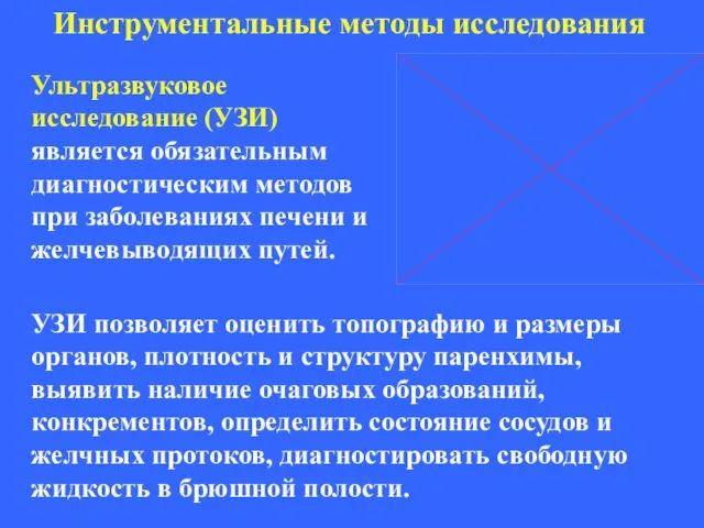 Инструментальные методы исследования Ультразвуковое исследование (УЗИ) является обязательным диагностическим методов