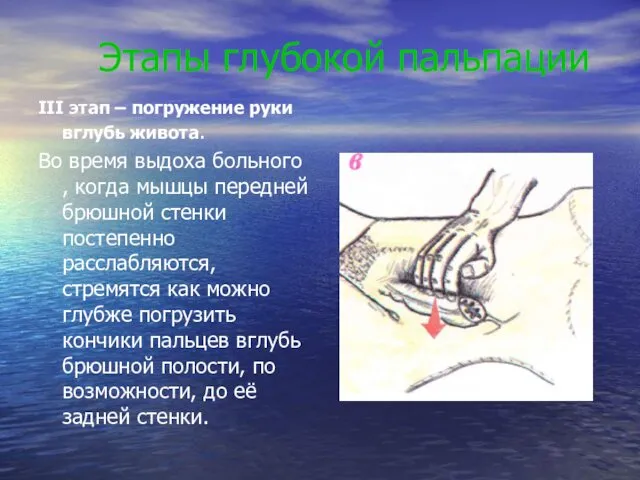 Этапы глубокой пальпации III этап – погружение руки вглубь живота.