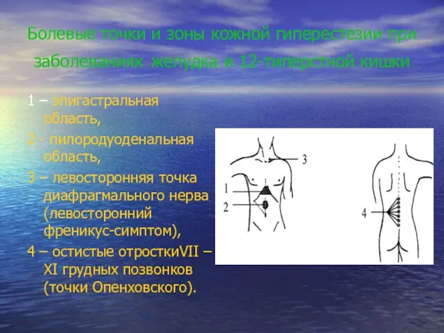 Болевые точки и зоны кожной гиперестезии при заболеваниях желудка и