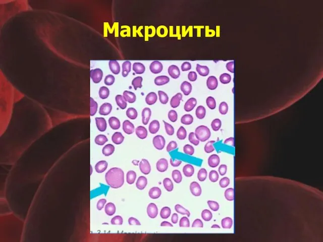 Макроциты