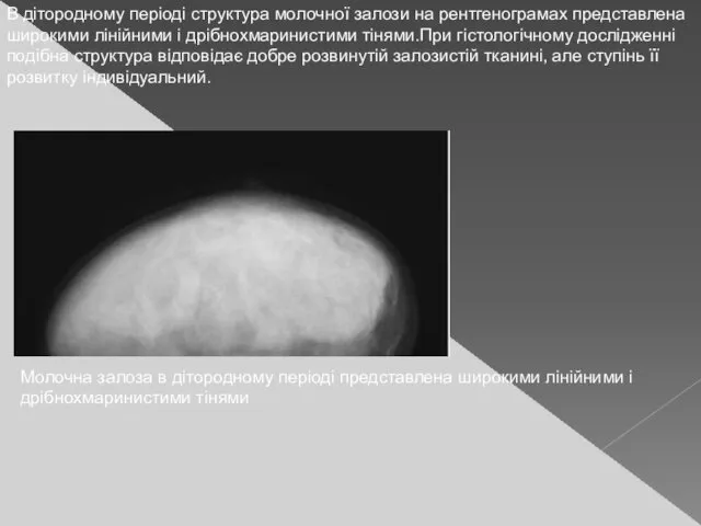 В дітородному періоді структура молочної залози на рентгенограмах представлена широкими