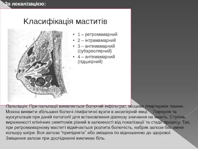 За локалізацією: Пальпація: При пальпації виявляється болючий інфільтрат, місцева гіпертермія