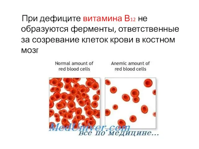 При дефиците витамина В12 не образуются ферменты, ответственные за созревание клеток крови в костном мозге