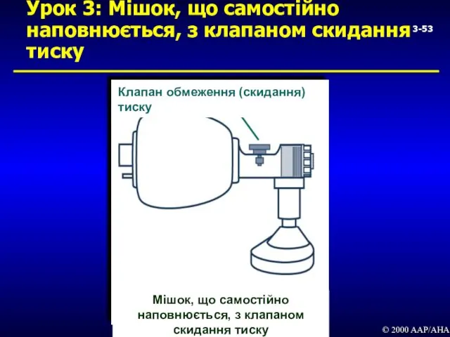 3- Урок 3: Мішок, що самостійно наповнюється, з клапаном скидання