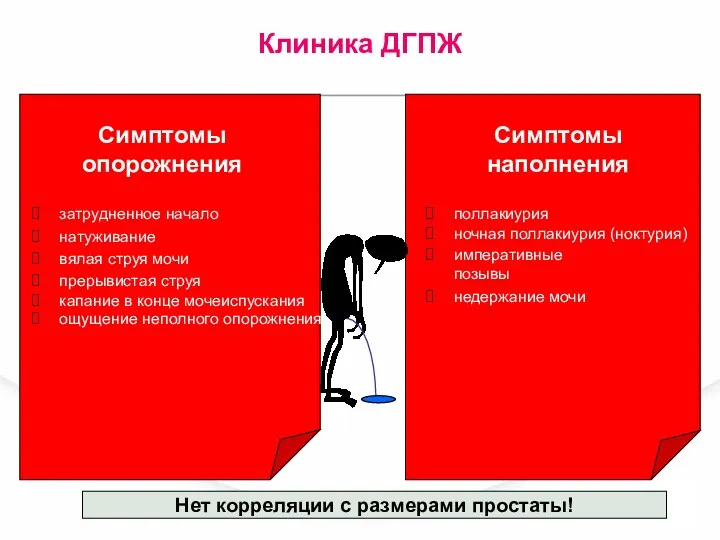 затрудненное начало натуживание вялая струя мочи прерывистая струя капание в