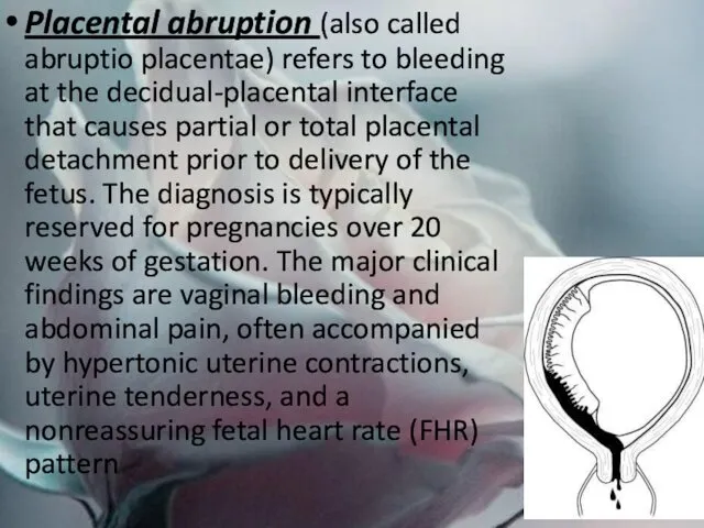 Placental abruption (also called abruptio placentae) refers to bleeding at the decidual-placental interface