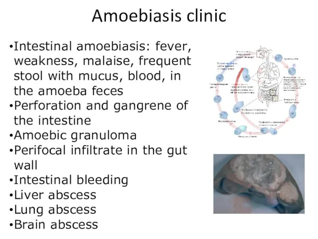 Amoebiasis clinic Intestinal amoebiasis: fever, weakness, malaise, frequent stool with mucus, blood, in