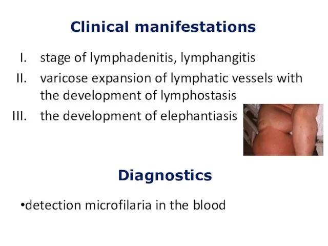 stage of lymphadenitis, lymphangitis varicose expansion of lymphatic vessels with